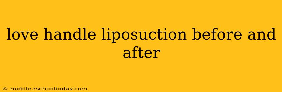 love handle liposuction before and after