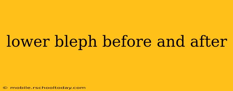 lower bleph before and after