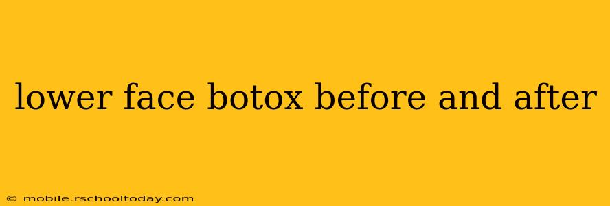 lower face botox before and after