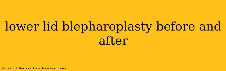 lower lid blepharoplasty before and after