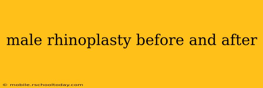 male rhinoplasty before and after