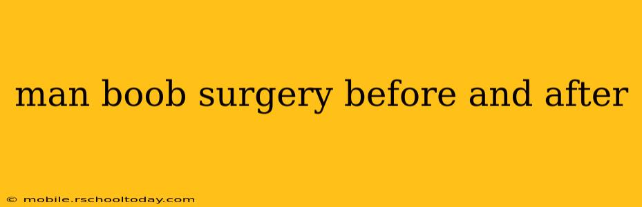 man boob surgery before and after