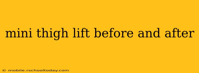 mini thigh lift before and after