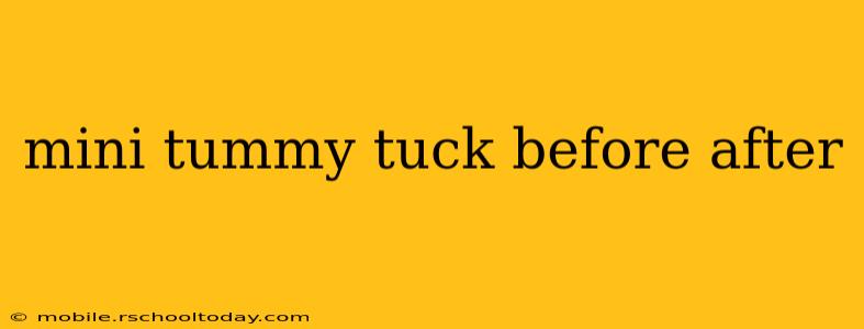 mini tummy tuck before after