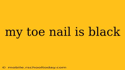 my toe nail is black