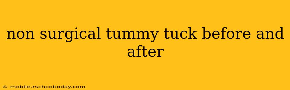 non surgical tummy tuck before and after