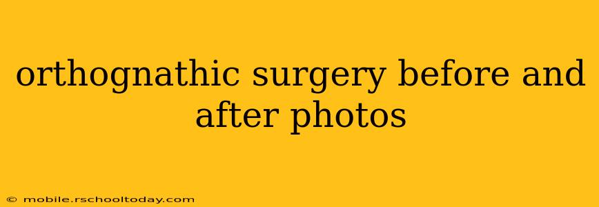 orthognathic surgery before and after photos