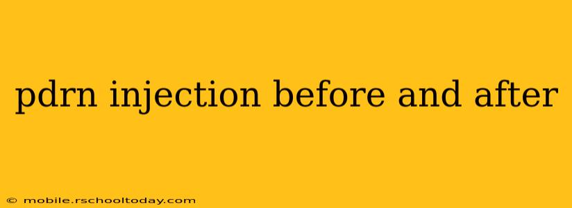 pdrn injection before and after