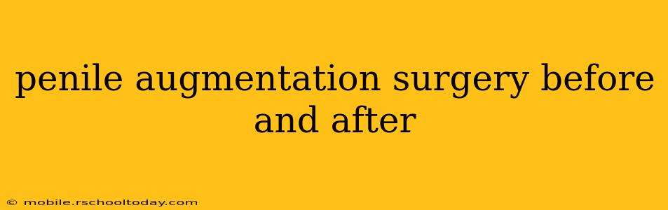 penile augmentation surgery before and after