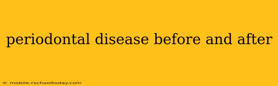 periodontal disease before and after