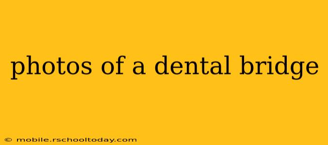 photos of a dental bridge