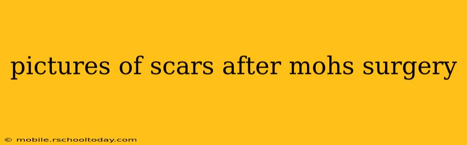 pictures of scars after mohs surgery