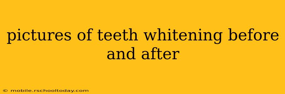 pictures of teeth whitening before and after