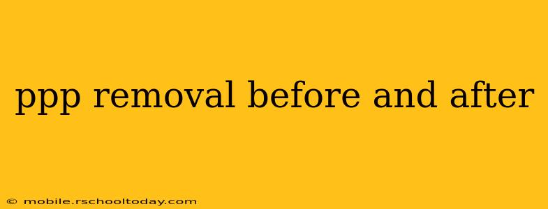 ppp removal before and after