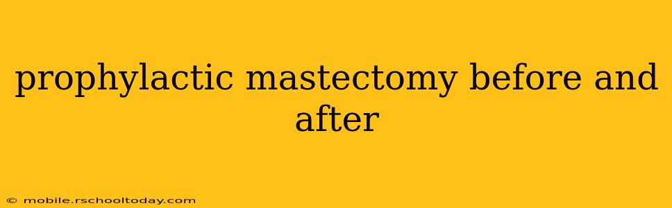 prophylactic mastectomy before and after