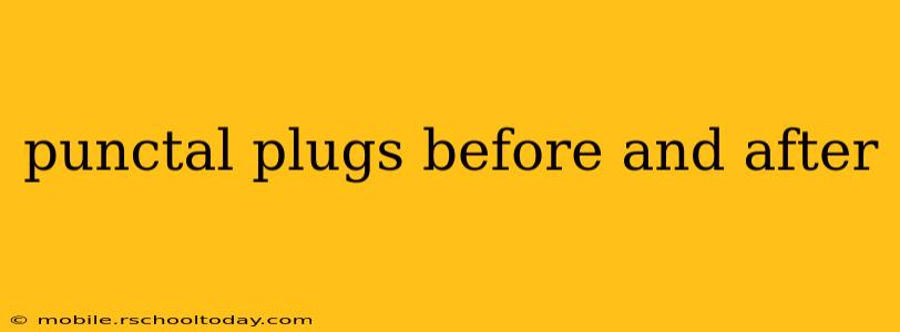 punctal plugs before and after