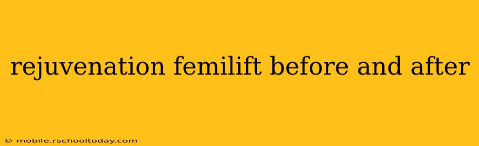 rejuvenation femilift before and after