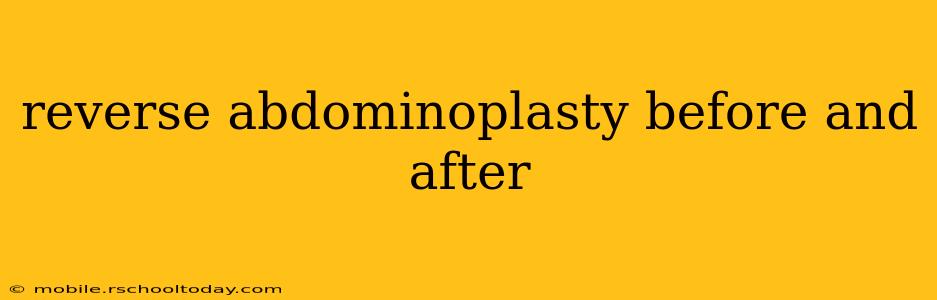 reverse abdominoplasty before and after