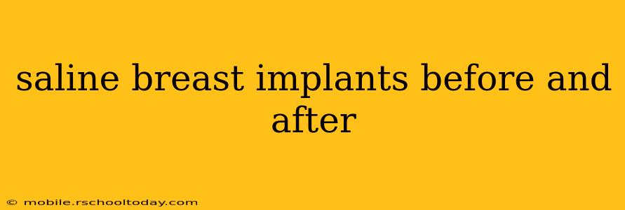 saline breast implants before and after