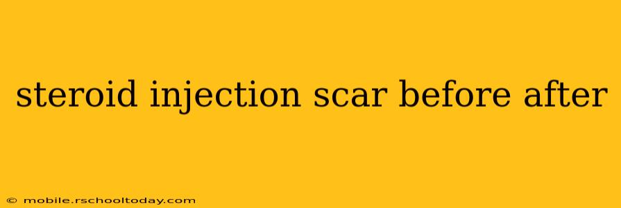 steroid injection scar before after