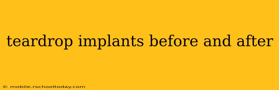 teardrop implants before and after