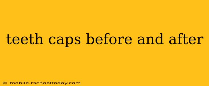 teeth caps before and after
