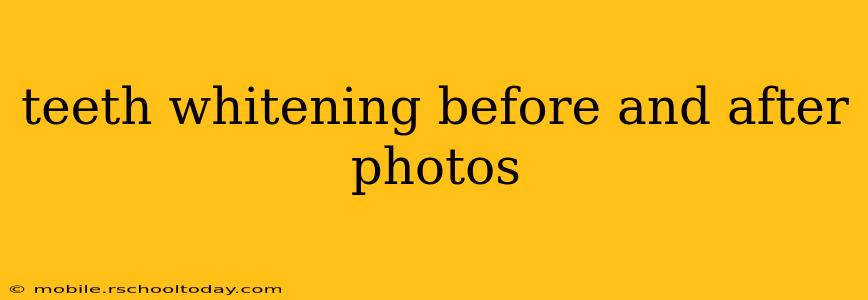teeth whitening before and after photos