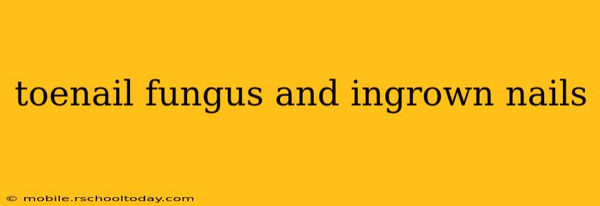 toenail fungus and ingrown nails