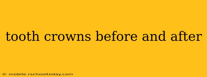 tooth crowns before and after