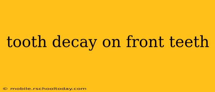 tooth decay on front teeth