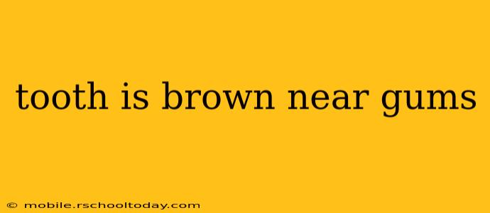 tooth is brown near gums