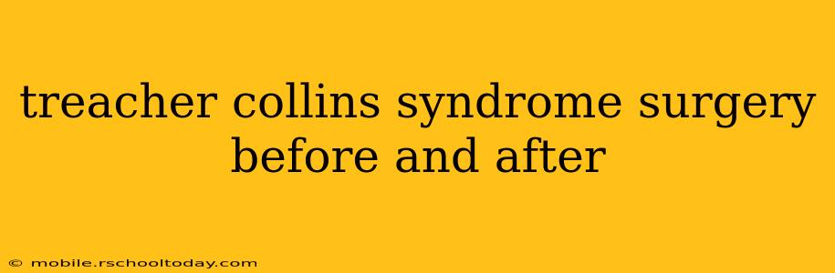 treacher collins syndrome surgery before and after