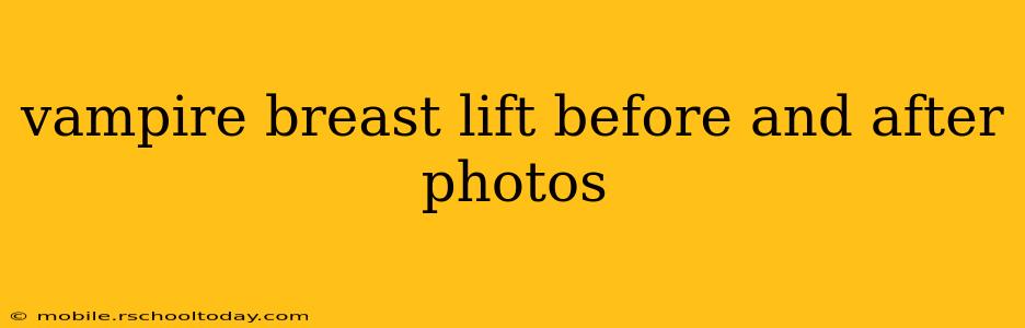 vampire breast lift before and after photos