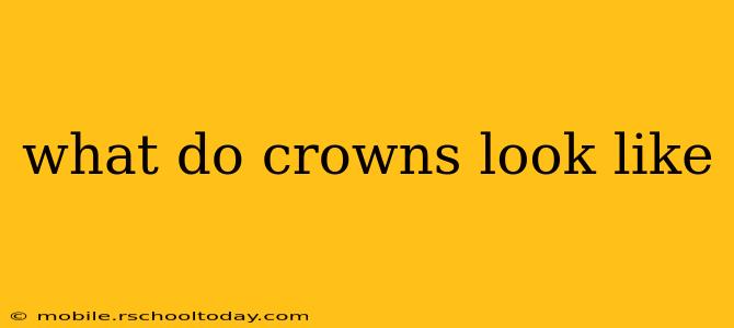 what do crowns look like