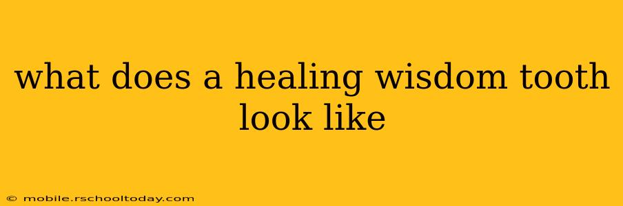 what does a healing wisdom tooth look like
