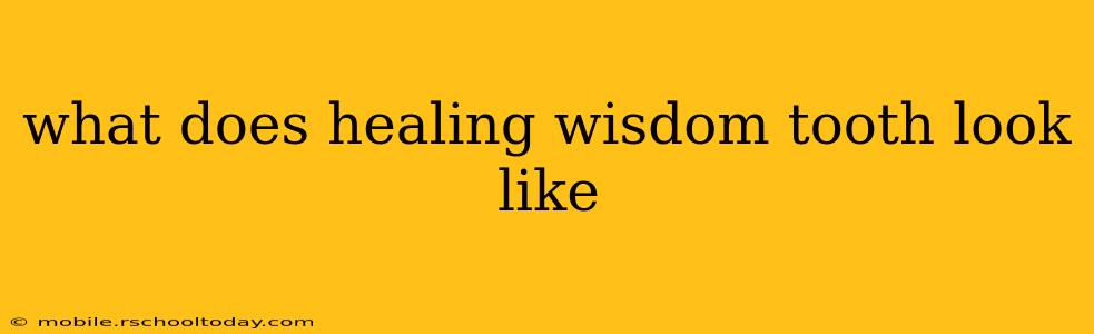 what does healing wisdom tooth look like