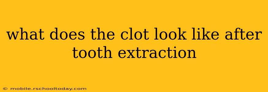 what does the clot look like after tooth extraction