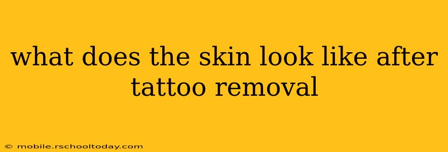 what does the skin look like after tattoo removal