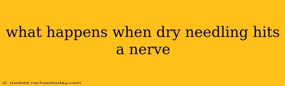 what happens when dry needling hits a nerve