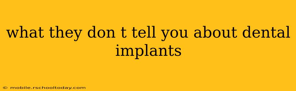 what they don t tell you about dental implants