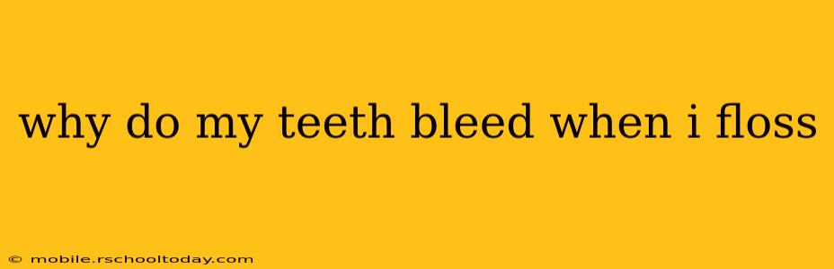 why do my teeth bleed when i floss