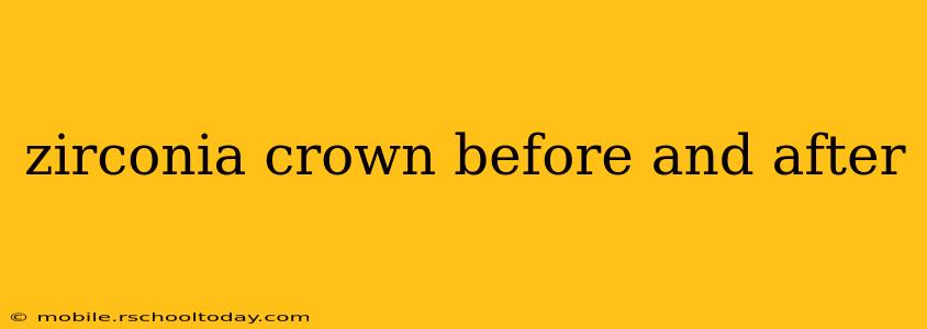 zirconia crown before and after